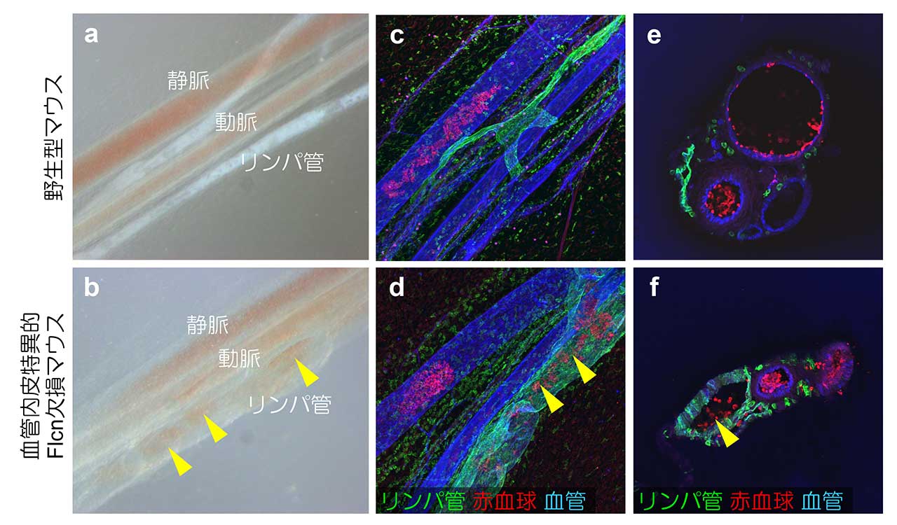 図1. 血管内皮特異的Flcn欠損マウスにおける血管―リンパ管異常吻合