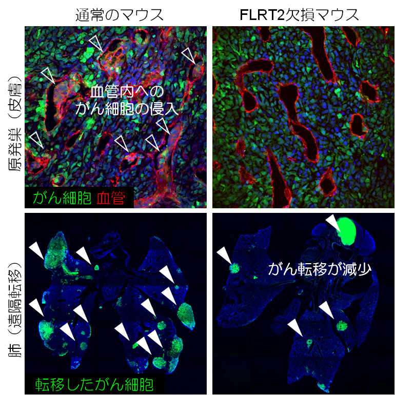 図1. FLRT2欠損マウスではがんの血管内侵入が抑えられ、がん転移が減少する。